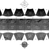 Photo-atlas of asteroid Vesta based on Low Altitude Mapping Orbit (LAMO) image data