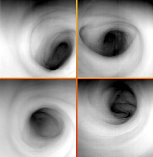 The many faces of Venus' south polar vortex