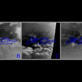 Surface changes on Titan