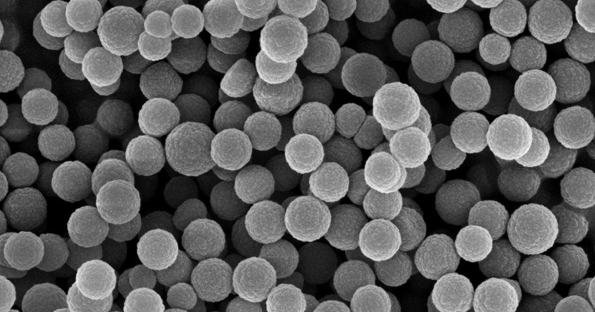 Scanning electron micrograph of tholin… | The Planetary Society